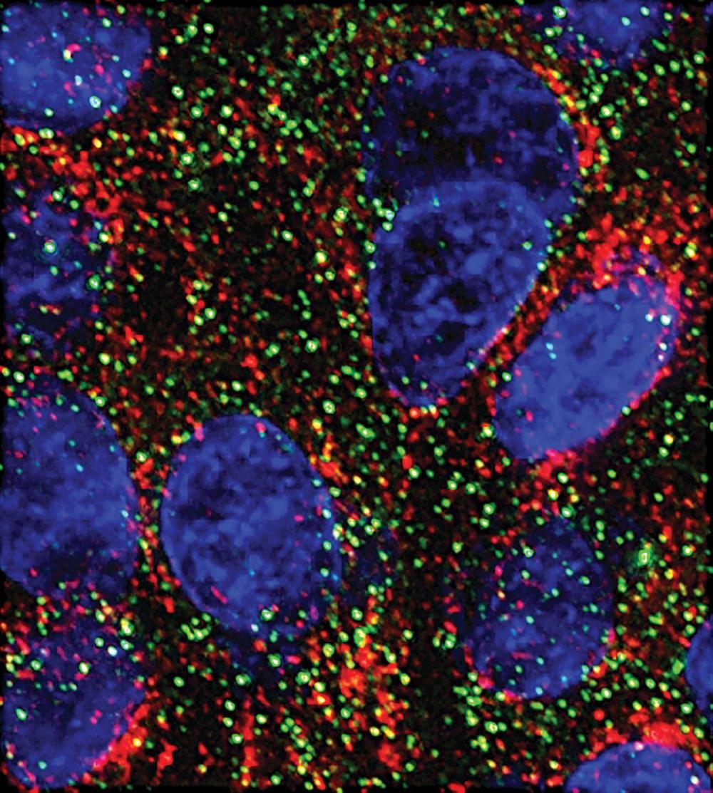 Dos microARN experiments frenan el crecimiento de células pancreáticas en laboratorio